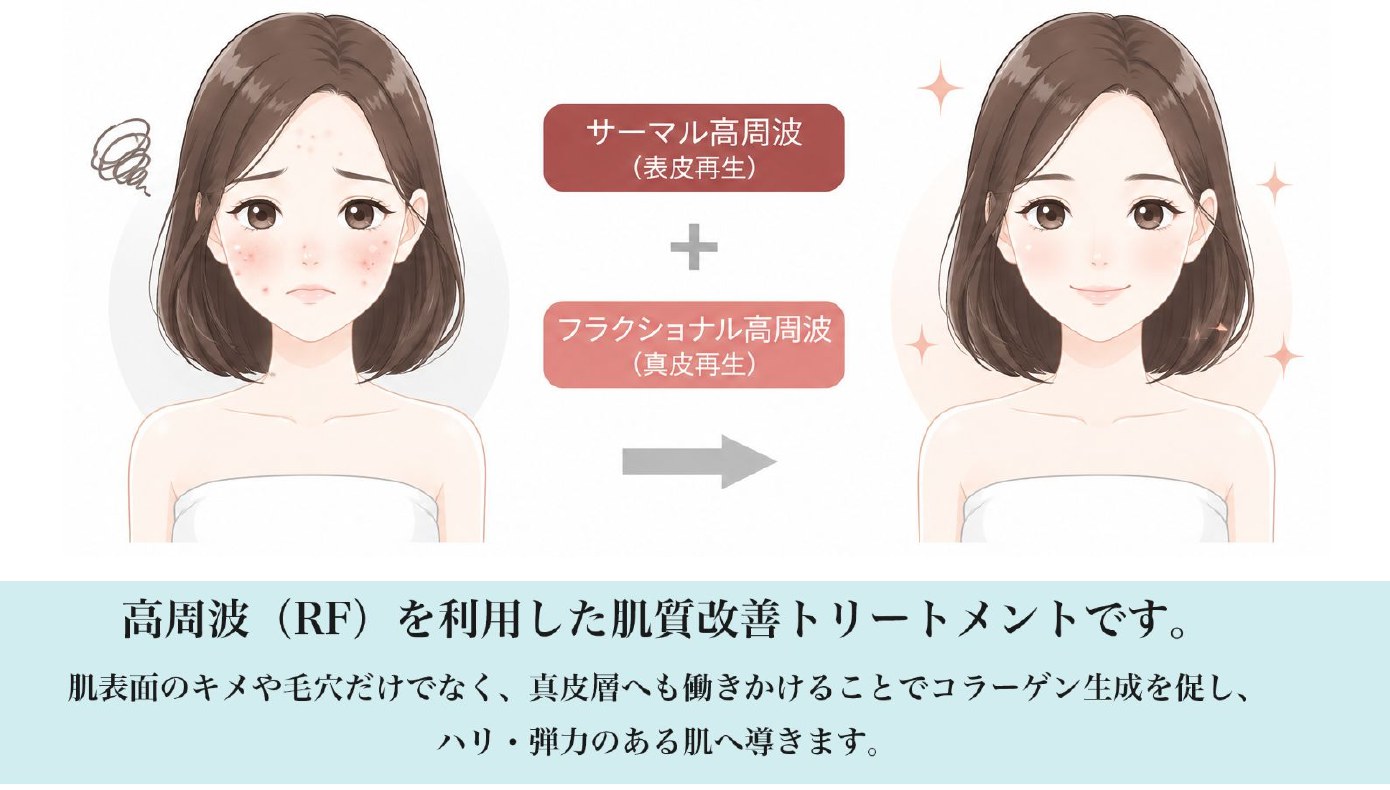 エステ版ポテンツァ発想のエッグフラクショナル イメージ